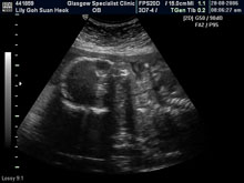 Vivian Sonograms